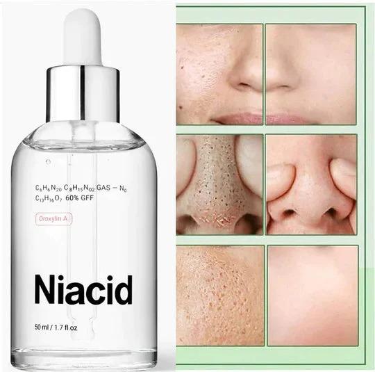 Unique Niacid Serum For Men & Women - Limited Stock ( Fully Tested & Successful )