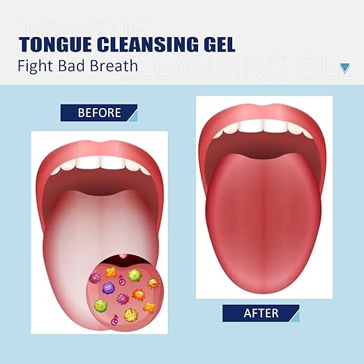 Tongue Cleansing Gel - BUY 1 GET 1 FREE