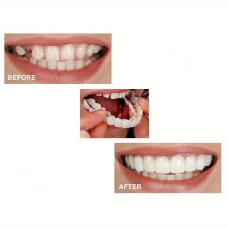 UNIQUE & DIURABLE Temporary Teeth Braces Cover - FLAT 50% OFF SHOP NOW !