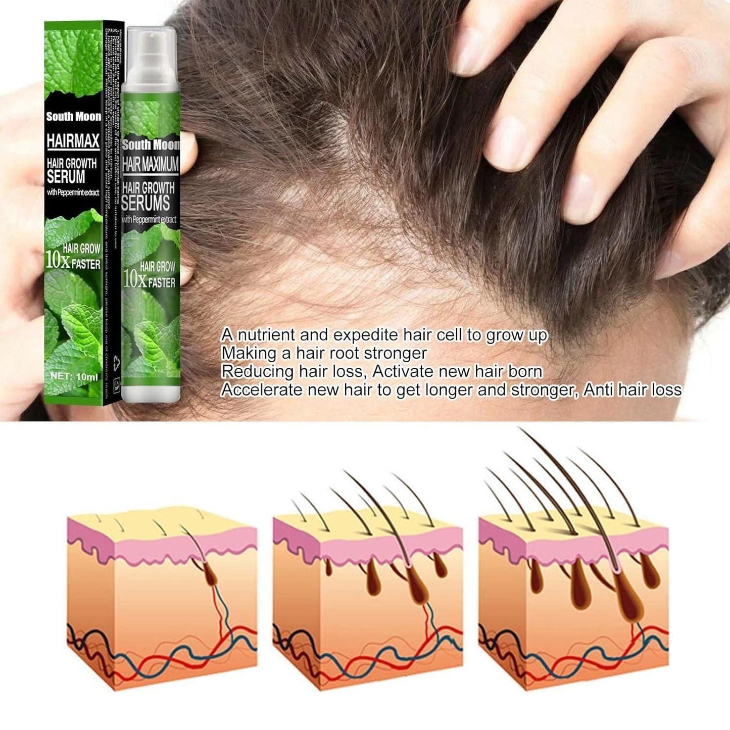 Ginger Plant Extract Anti-Hair Loss Hair Serum ( BUY 1 GET 1 FREE)