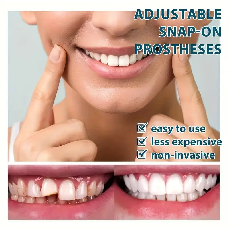 UNIQUE & DIURABLE Temporary Teeth Braces Cover - FLAT 50% OFF SHOP NOW !